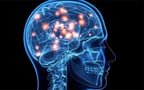 Does Porn Rewire Our Brains?