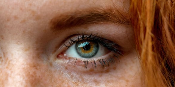 Photo of a woman with freckles Photo of a woman with freckles