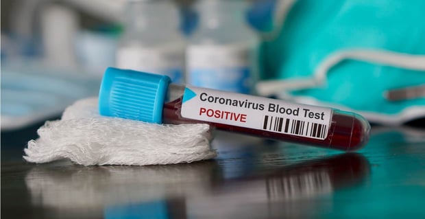 Dating And Coronavirus
