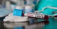 5 Dating Tips for the Coronavirus Pandemic[updated_month_year before=" (" after=")"]