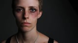 LGBT Teens are More Likely to Experience Dating Violence
