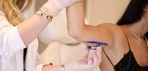 medspa procedure
