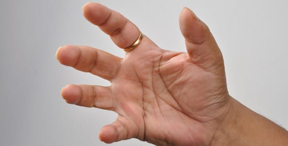Photo of man's hands