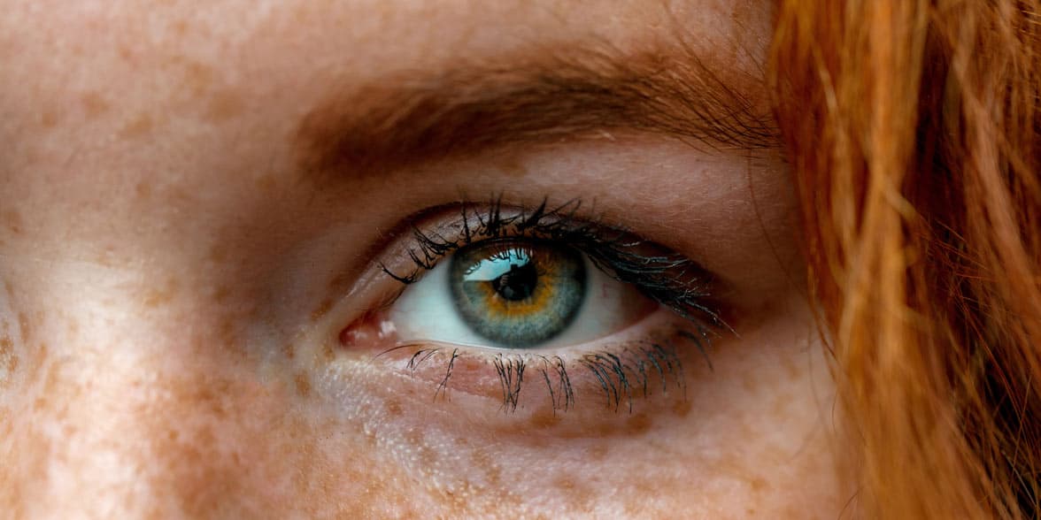 Photo of a woman with freckles Photo of a woman with freckles